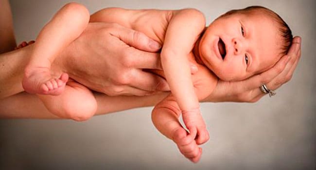 Caesarean birth, prolonged labour influence childhood health: study