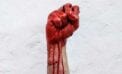 War bloody fist Canada’s human rights record marred by hypocrisy