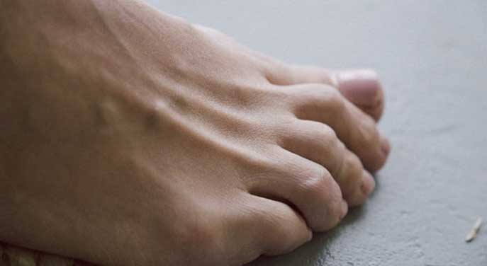 foot Sensors embedded in bandages could monitor diabetic foot wounds