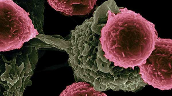 New cancer ‘tracer’ promises to detect more tumours earlier
